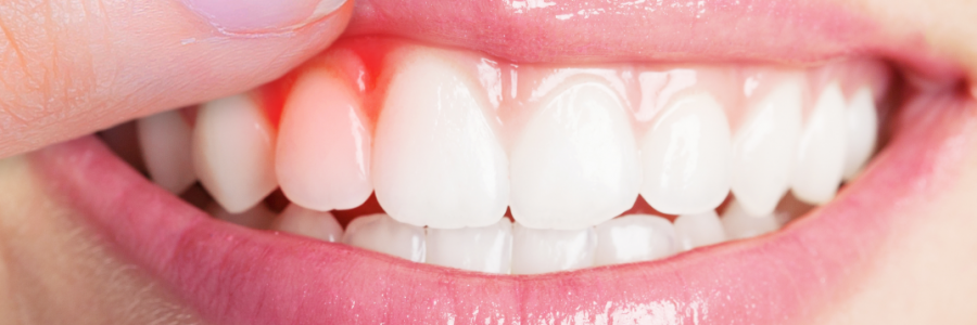 又上火又怕冷？上熱下寒、水火不濟(jì)，教你調(diào)回來！