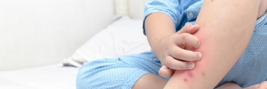 學(xué)古人這樣驅(qū)蚊，從此不再“蚊”風(fēng)喪膽！