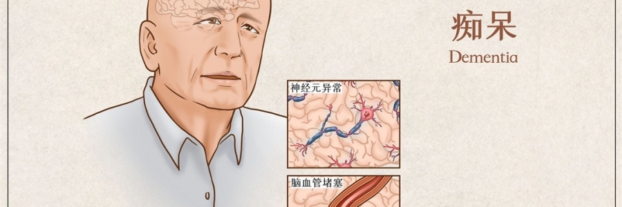 “馬什么梅？”年紀(jì)輕輕老忘事，竟是癡呆的前兆？！