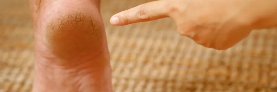 每天跺跺腳，從腳養(yǎng)到頭，越跺越年輕！